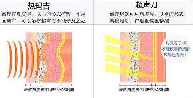 做一次thermage热玛吉要多少钱？