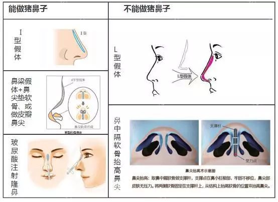 女星趴车窗力证自己没整形？可谁说隆鼻后鼻尖一定不能上推的？！ 