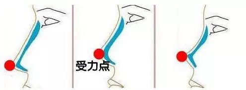 女星趴车窗力证自己没整形？可谁说隆鼻后鼻尖一定不能上推的？！ 