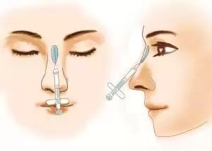 女星趴车窗力证自己没整形？可谁说隆鼻后鼻尖一定不能上推的？！ 