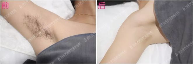 汕头华美优惠价格表~两人同行，一人免单！