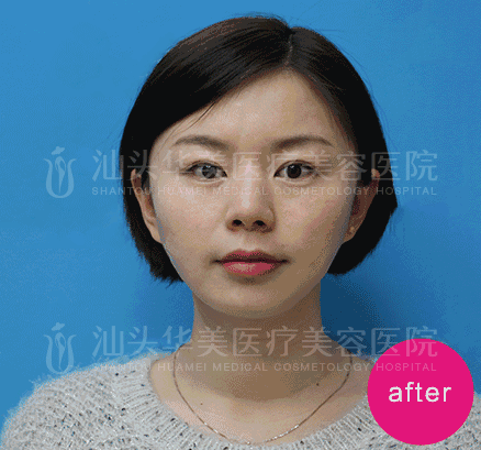 汕头华美优惠价格表~两人同行，一人免单！