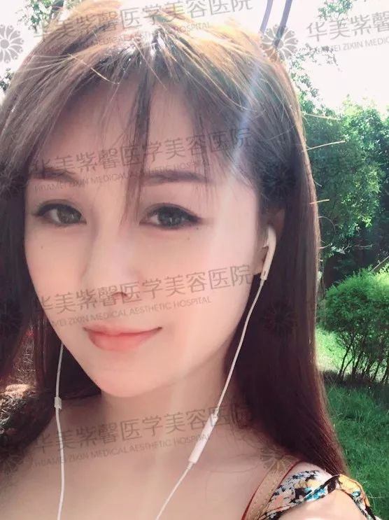华美紫馨整形医院：47岁的ta整容190余次，只为变成明星！