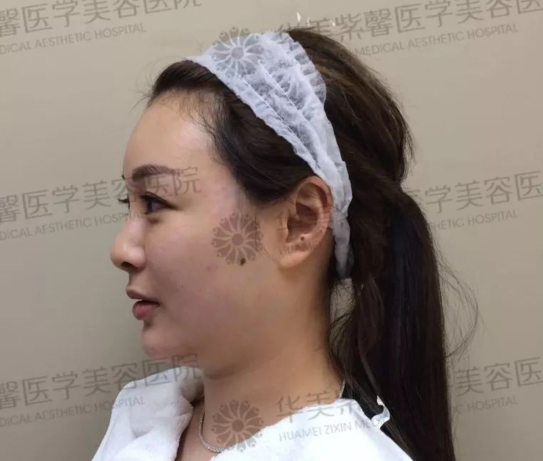 华美紫馨整形医院：47岁的ta整容190余次，只为变成明星！