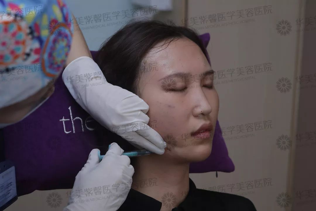 华美紫馨整形医院：47岁的ta整容190余次，只为变成明星！