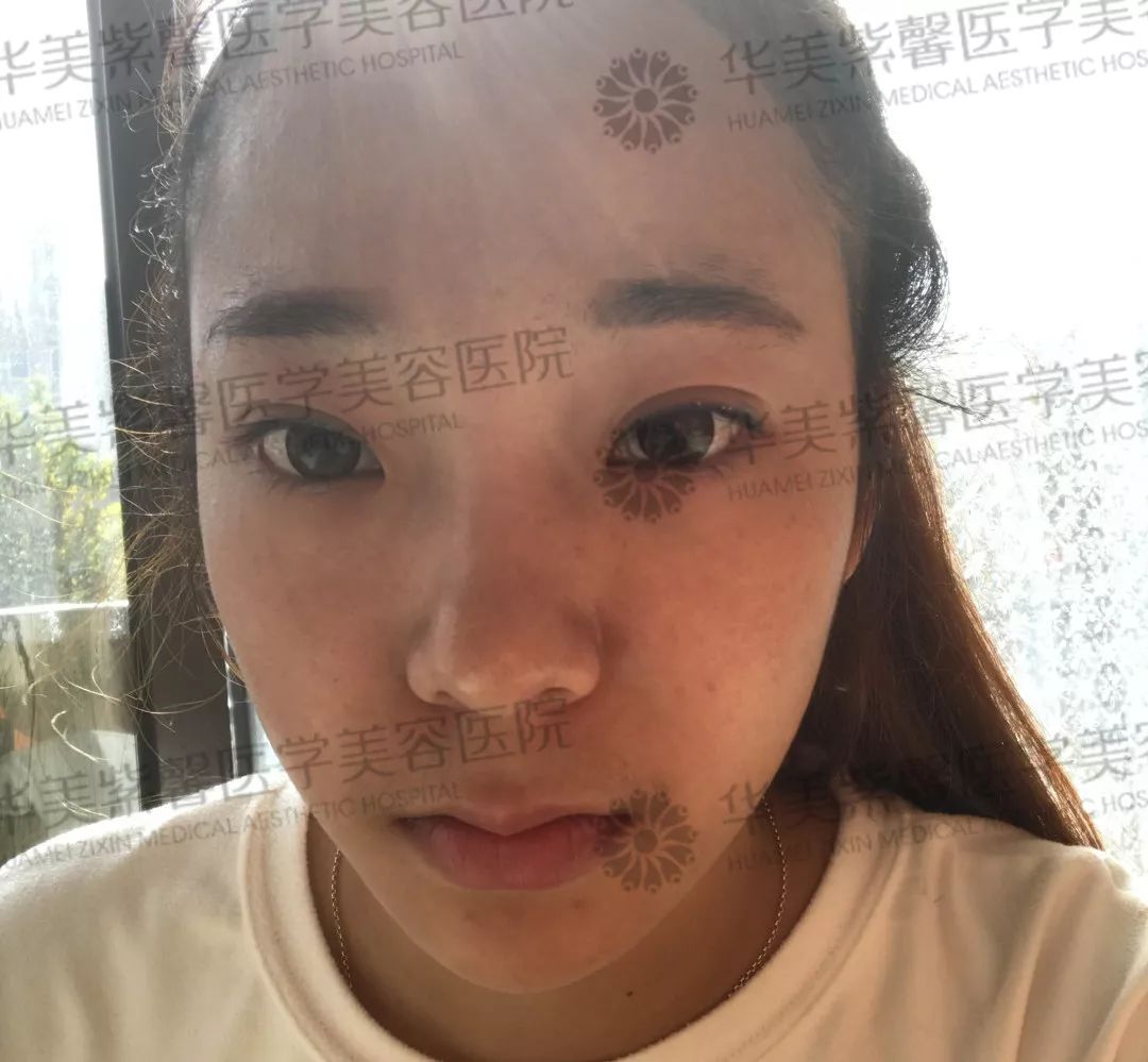 华美紫馨整形医院：47岁的ta整容190余次，只为变成明星！