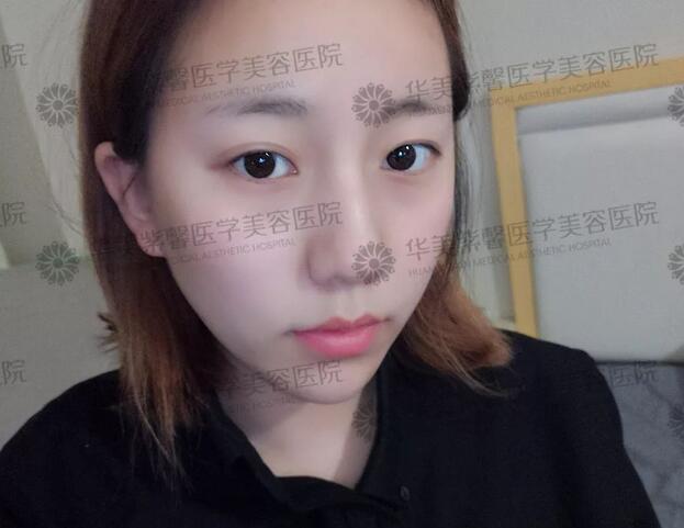 华美紫馨整形医院：47岁的ta整容190余次，只为变成明星！