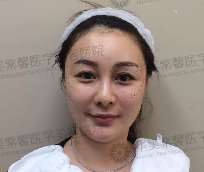 华美紫馨整形医院：47岁的ta整容190余次，只为变成明星！