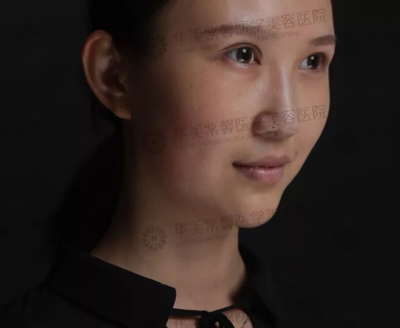 华美紫馨整形医院：47岁的ta整容190余次，只为变成明星！