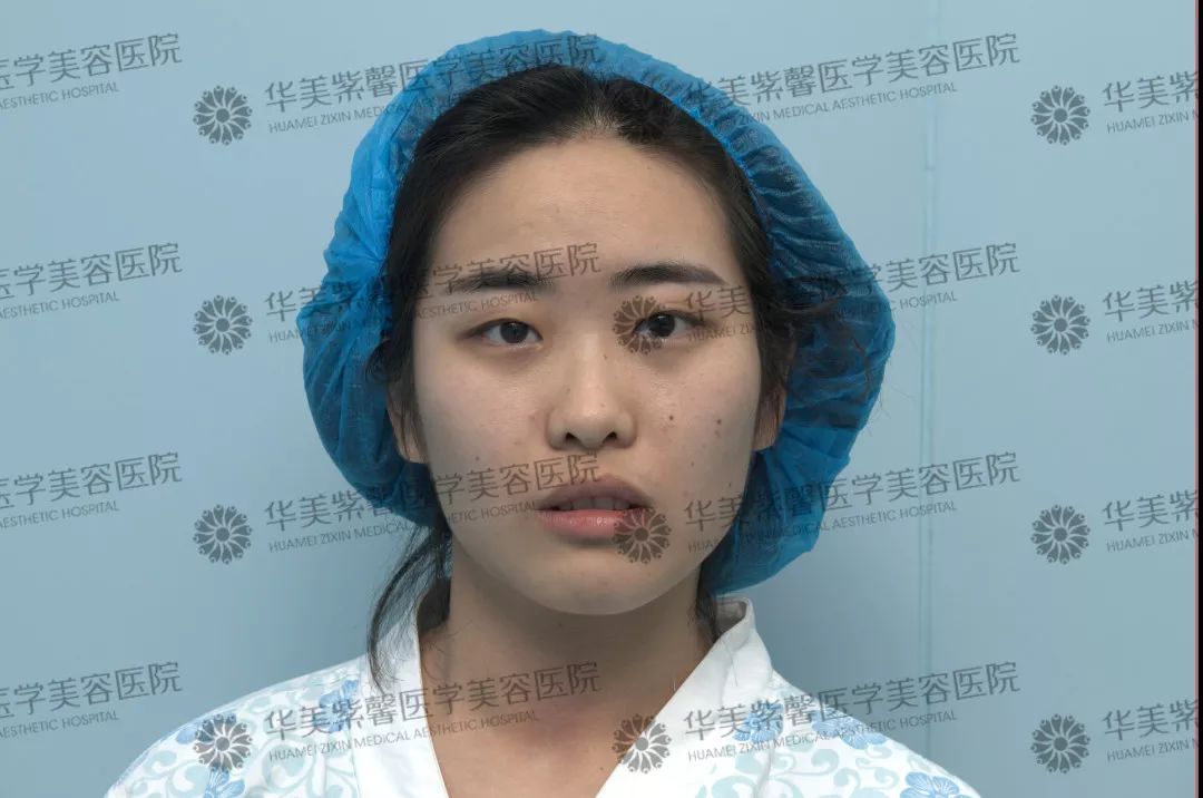 华美紫馨整形医院：47岁的ta整容190余次，只为变成明星！