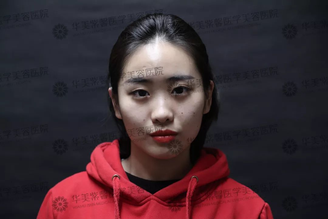 华美紫馨整形医院：47岁的ta整容190余次，只为变成明星！