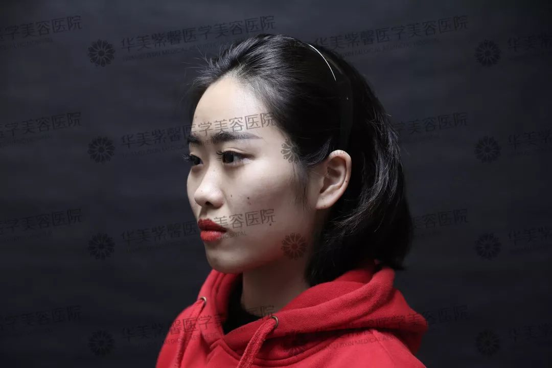 华美紫馨整形医院：47岁的ta整容190余次，只为变成明星！