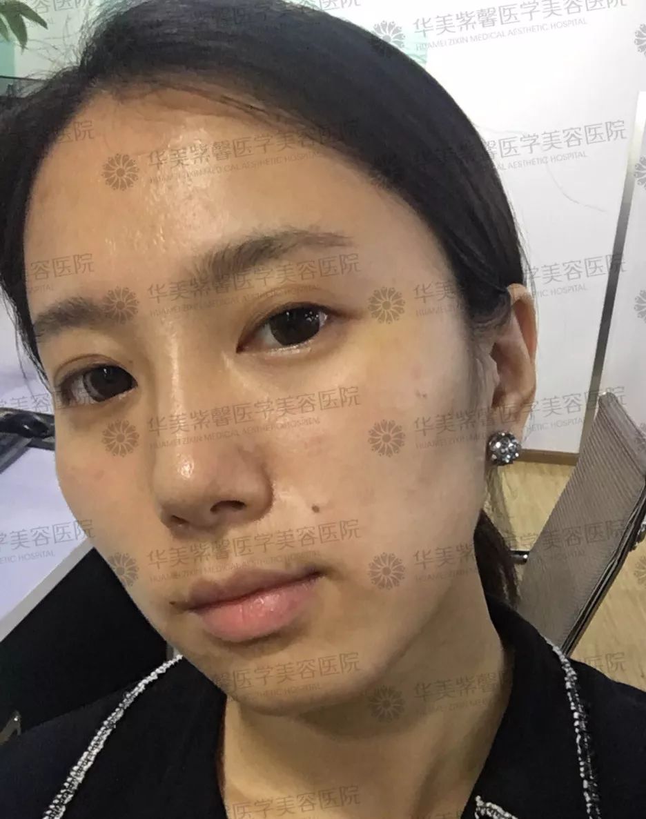 华美紫馨整形医院：47岁的ta整容190余次，只为变成明星！
