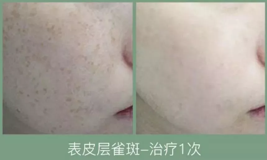 你过得好不好，看脸就知道了.春节聚会、相亲，这些准备现在就要做起来了!