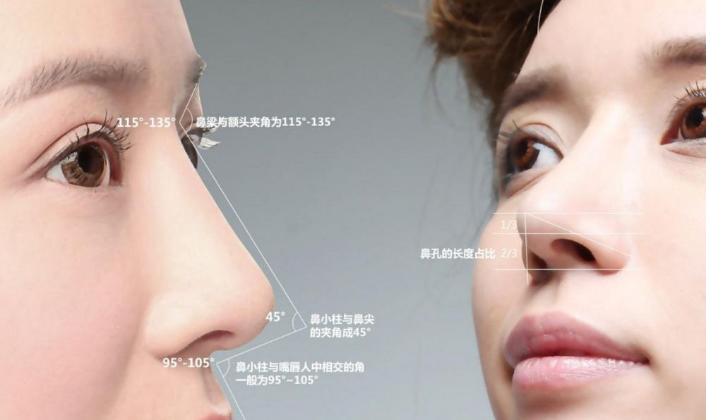 鼻梁塌?两种方式让鼻梁挺翘