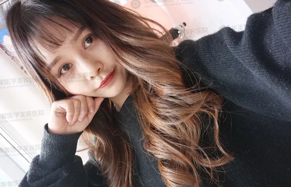 自体脂肪填充苹果肌、额头、下巴、眼窝的优势？谁来说说~
