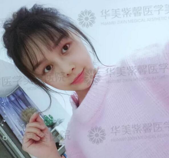 自体脂肪填充苹果肌、额头、下巴、眼窝的优势？谁来说说~