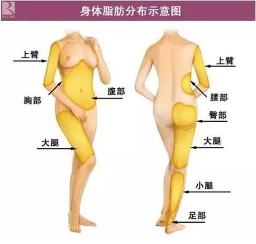 360度环形吸脂减肥果怎么样呢？给我看看图片呐~