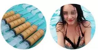 乳房下垂悬吊术一个月真实案例——南京艺星~
