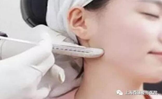 【注射瘦脸打几次能定型？打注射瘦脸会反弹吗？】