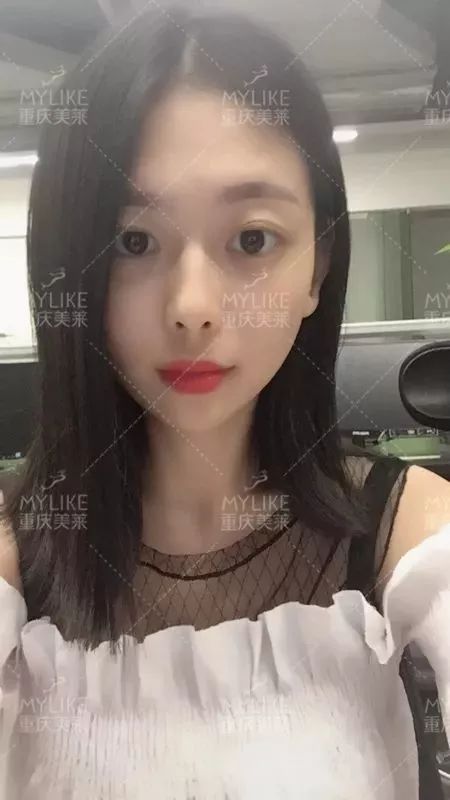 磨颧骨前后对比图，颧骨整形有失败案例吗？