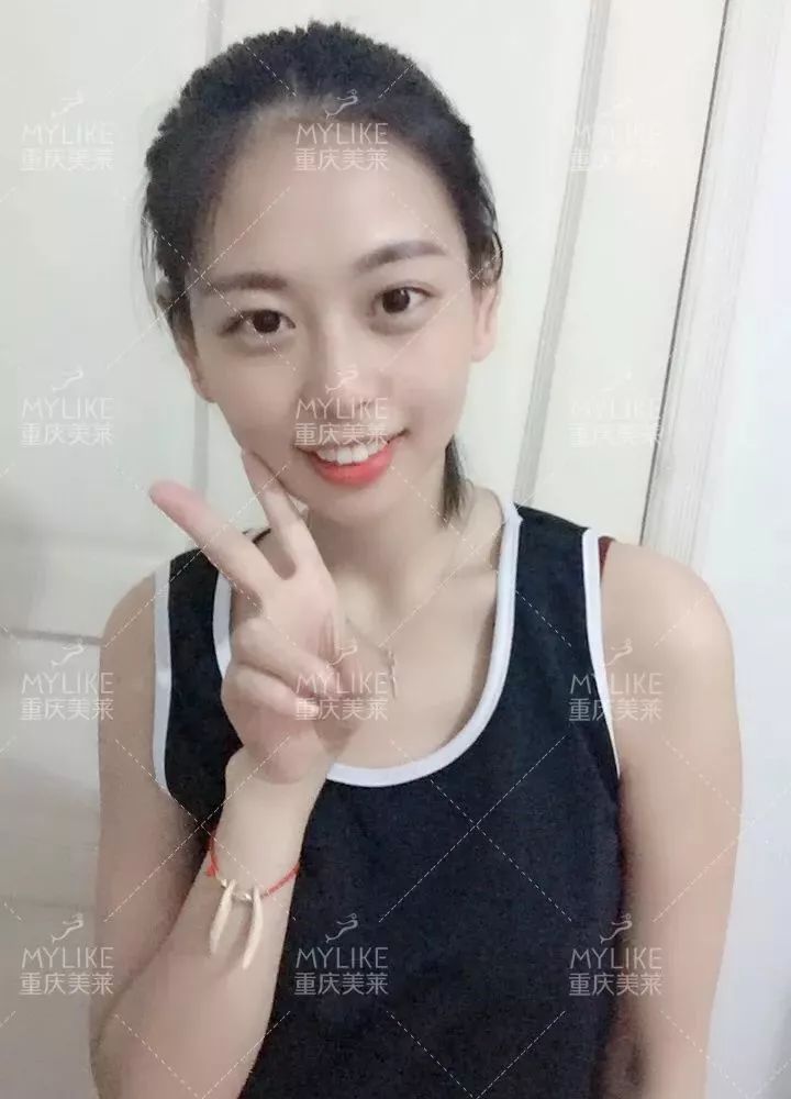 磨颧骨前后对比图，颧骨整形有失败案例吗？