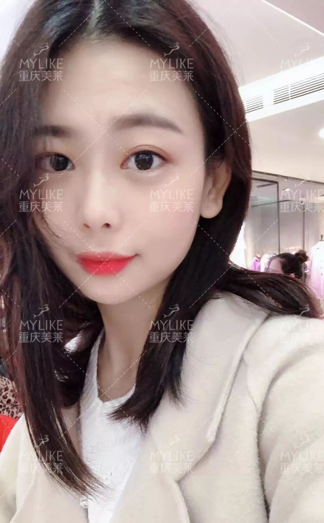 磨颧骨前后对比图，颧骨整形有失败案例吗？