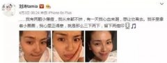 OPT光子嫩肤脱毛是啥玩意儿？OPT光子嫩肤脱毛好吗？ width=