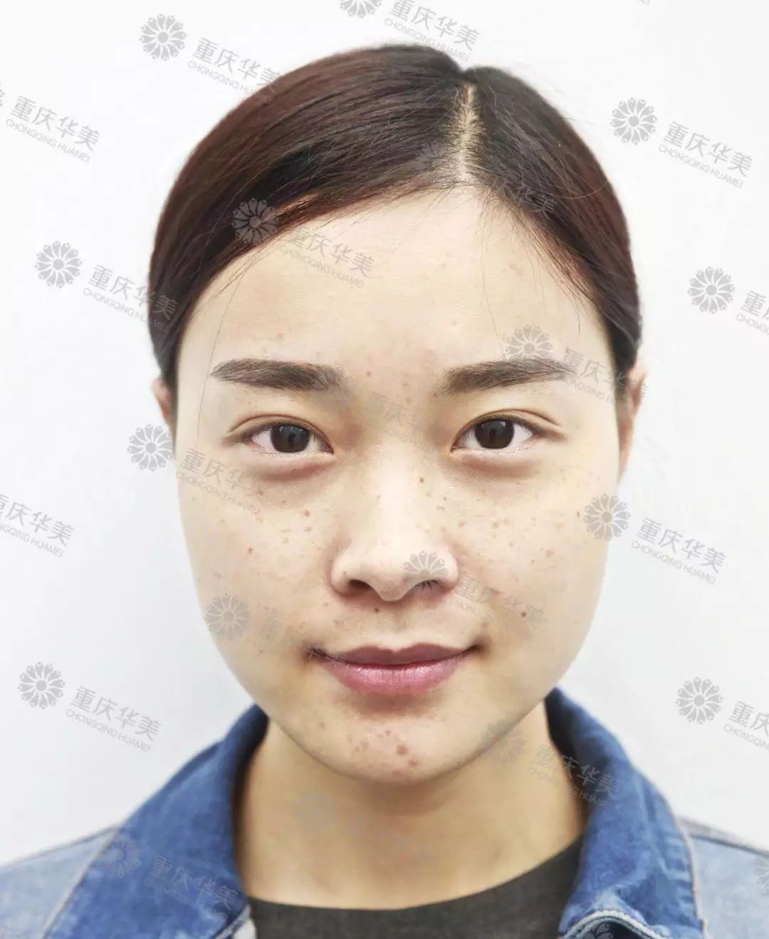 光魔动力分层祛斑：脸上有斑的女生，小心30岁的时候颜值崩掉！