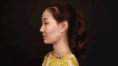 割双眼皮到底疼不疼？这个“鹦鹉人”较有发言权！ 