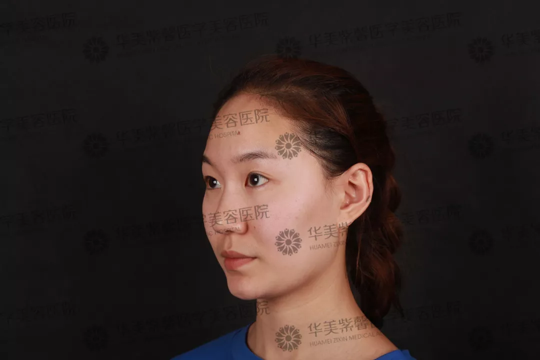 割双眼皮到底疼不疼？这个“鹦鹉人”较有发言权！ 
