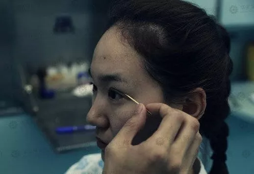 割双眼皮到底疼不疼？这个“鹦鹉人”较有发言权！ 