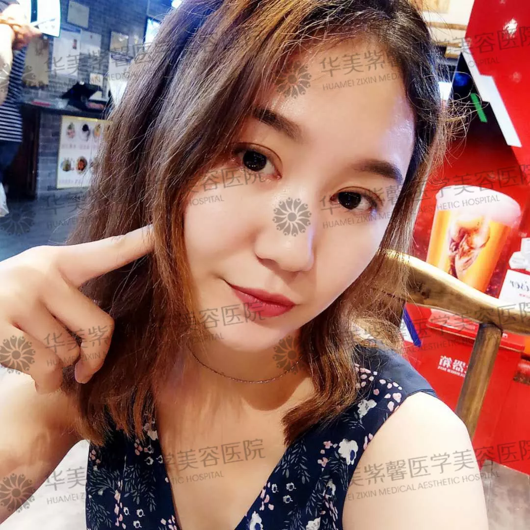 割双眼皮到底疼不疼？这个“鹦鹉人”较有发言权！ 