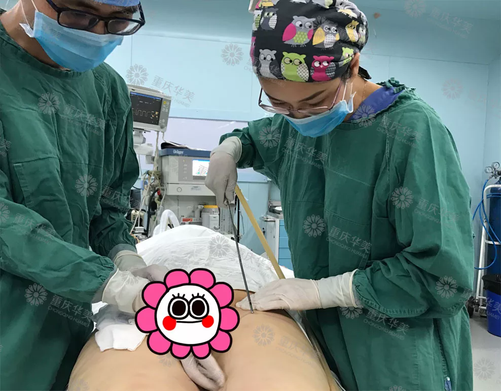 【节后减肥自救指南】吸脂瘦身又塑型，快速瘦美~ width=