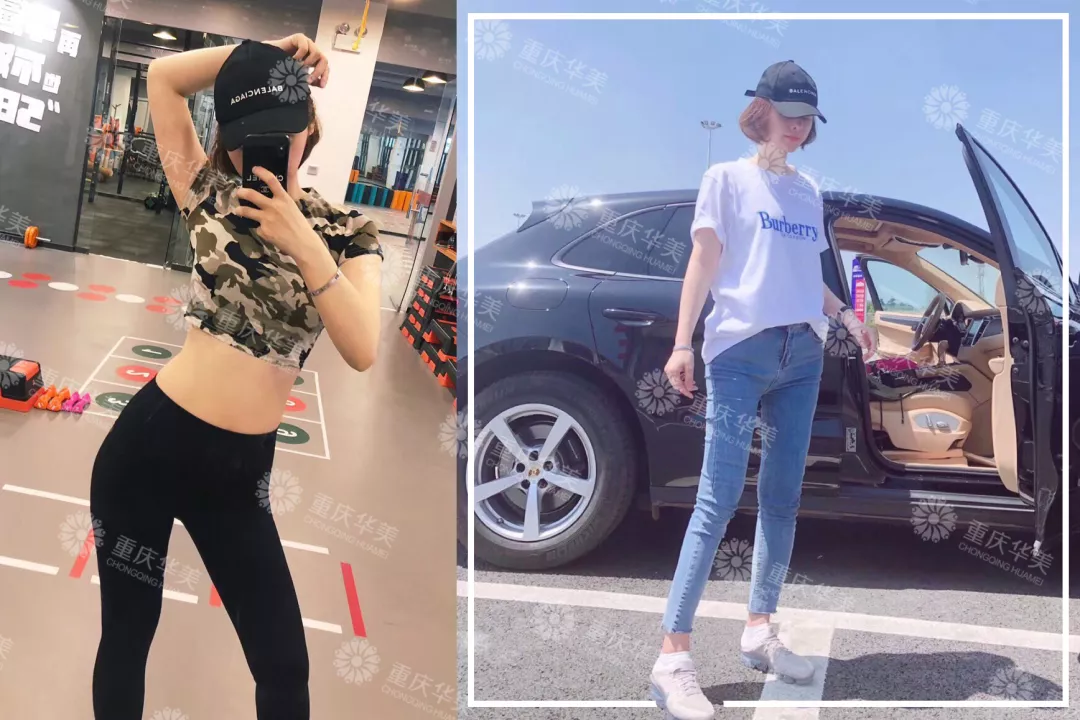 【节后减肥自救指南】吸脂瘦身又塑型，快速瘦美~