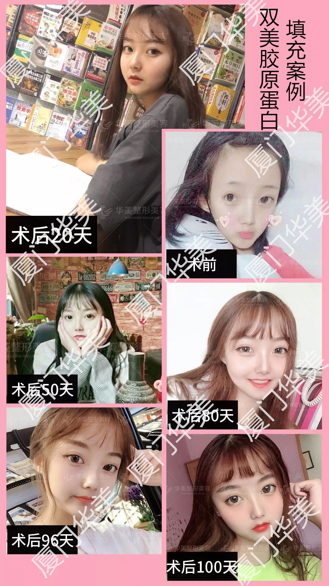 【2月17日丨双美紧致专场】春节后的憔悴显老？怎么挽救？