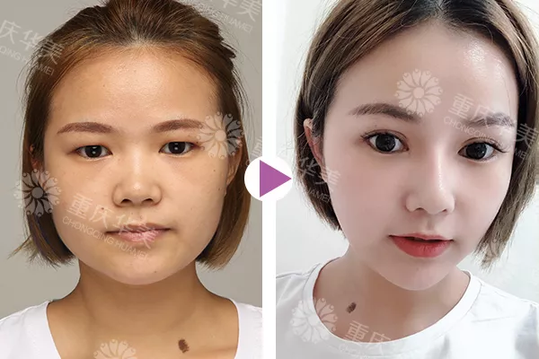 元气女神陈yi涵产子，那双青春厉害的双眼皮终于后继有人啦~