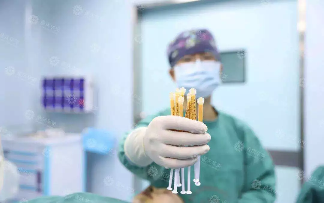 改造奚梦瑶同款凹陷脸，怎样填充得不露痕迹？