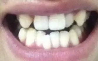 Baby同款犬系脸长我脸上，为啥我没有她好看呢？