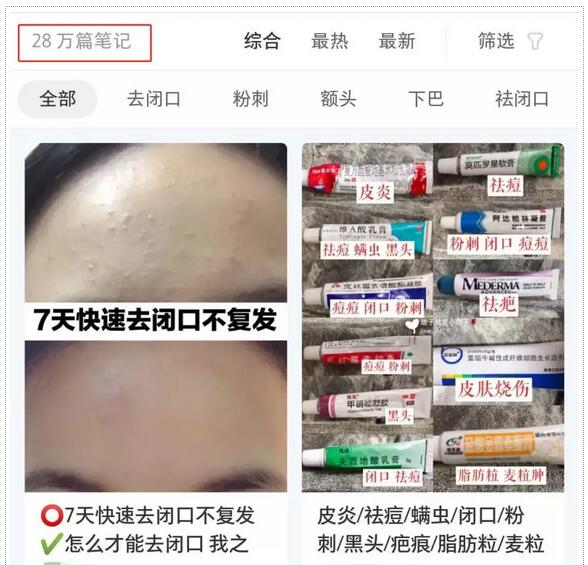 【总是长闭口痘痘？那你一定没试过这些好物！】