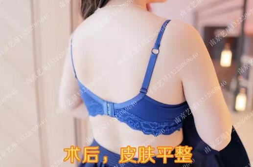 艺星螺旋吸脂术：神仙姐姐变大妈？离开滤镜后，真实身材曝光！