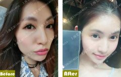 F4集体婚变？是她打注射瘦脸过量吗？ width=