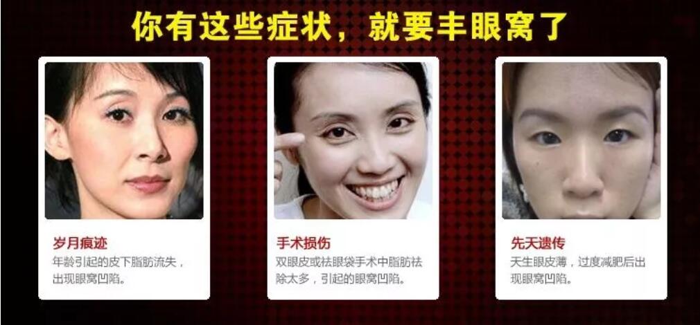内路祛眼袋是什么？内路祛眼袋有什么优势？Follow Me！