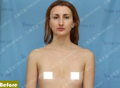 日记 | 隆胸整形全纪录！！揭秘“巨乳”背后的秘密… width=