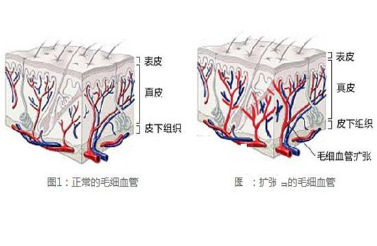 红血丝一直好不了你知道原因嘛?