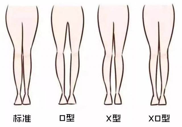 你的腿能完全靠拢吗?几招教你改良不良腿型