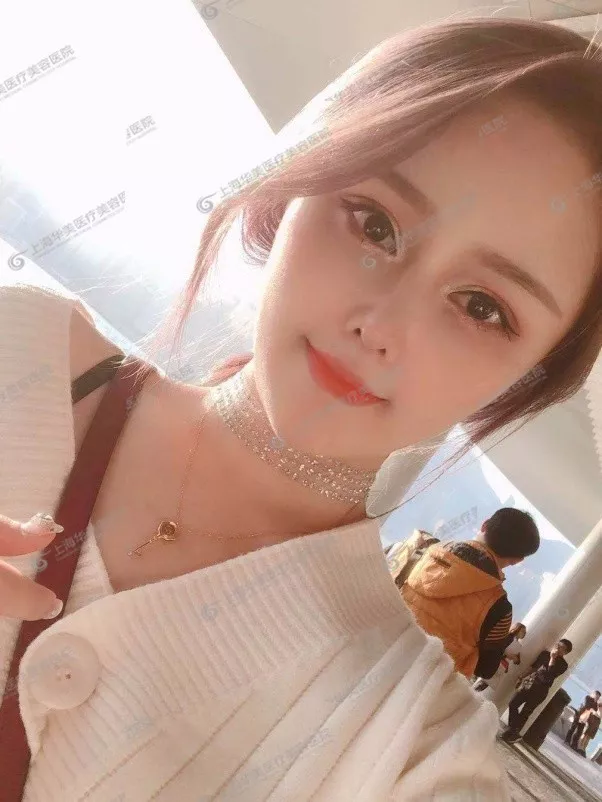 做双眼皮前不搞清楚这个问题，小心被坑惨~