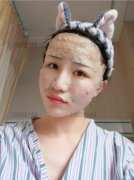 上海御颜脂肪填充面部日记案例 果全程直播 width=