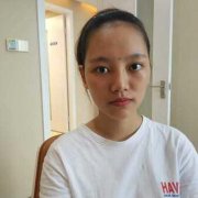 人工植发果恢复案例：年纪轻轻就秃顶不得不借助人工植发~ width=