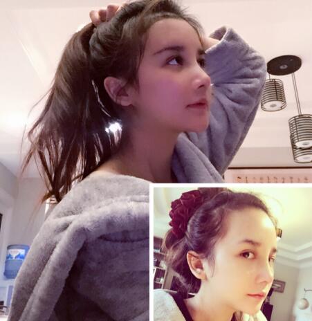 美人尖是什么样子的?来看看我的美人尖种植案例你就知道了